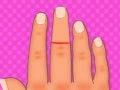                                                                     Finger surgery קחשמ