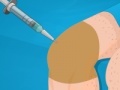                                                                     Operate Now: Knee Surgery קחשמ