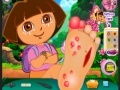                                                                     Dora Foot Injuries קחשמ