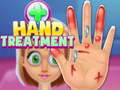                                                                      Hand Treatment ליּפש