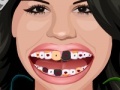                                                                     Selena Gomez Perfect Teeth  קחשמ